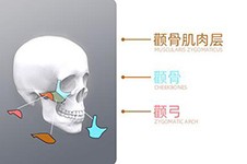 一针降颧骨颧弓的危害后遗症分享，这些人尽量不要做！