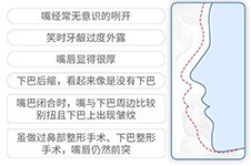 上海凸嘴矯正哪家醫(yī)院好，骨性凸嘴矯正這幾家做的不錯！