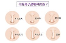 上海邱文苑做鼻子太普通了?这三点隆鼻优势你肯定不知道!