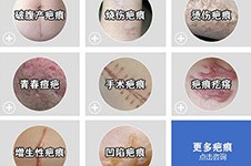 广州祛疤好的医院排名前五公布,在广州去疤痕这几家必面诊!