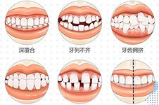 花都牙齿矫正哪家比较好?广州矫正牙齿正规医院推荐给你!