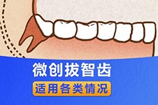 广州拔智齿要多少钱一颗？分享广州拔智齿便宜又好牙科！