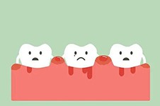 广州治疗牙周炎好的医院分享,有牙体牙髓病也可一并看看!