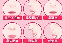 广州鼻子整形医院排名前十:各种鼻子问题选这几家不出错!