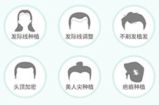 广州正规的植发医院排名表有吗？这十家技术好还靠谱！