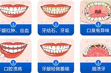 广州各个医院洗牙价格表公布,揭秘广州洗牙齿哪里比较好!