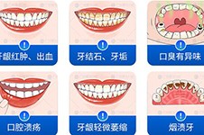 廣州各個醫(yī)院洗牙價格表公布,揭秘廣州洗牙齒哪里比較好!