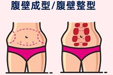 广州肖添有做拉皮手术怎么样?面部+腹壁成形是其优势特色!