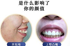 广州正颌手术排名前三私人医院公布,看广州正颌哪家技术好!