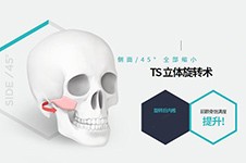 韩国做颧骨缩小技术好吗？TS整形外科三项特色优势展现！