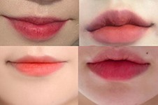 韩国UcanB整形丰唇改善不错，对比图分享真实结果！