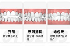 昆明整牙在哪家口腔医院比较好？雅度美奥柏德都不错！