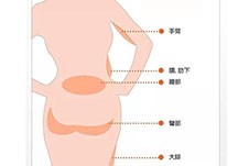 昆明哪個(gè)醫(yī)院抽脂手術(shù)做的好？有做全身抽脂不錯(cuò)的醫(yī)院?jiǎn)? title=