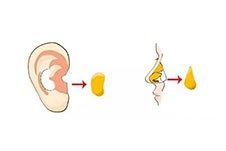 昆明耳软骨隆鼻多少钱？这几家医院价格差异有点大