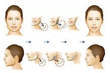 醫(yī)生傳授4種公認最有效的瘦臉方法，第四個親測有效