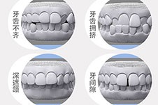 昆明儿童牙齿正畸医院排名 各路神庙打架的榜单