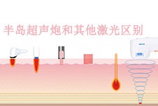 昆明哪家整形医院能做超声炮？这几家都有但价格不一样