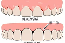 為什么很多醫(yī)生說矯正牙齒先要片切，片切是不是很可怕？