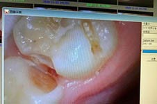 中山小榄哪家牙科门诊好，想要可靠的牙医推荐！