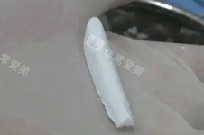 张洪波鼻子整形做的怎么样 鼻手术后和眼睛看起来也很协调