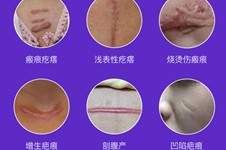 上海疤痕修复哪家医院好？上海清沁医疗美容怎么样？