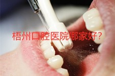 梧州看牙去哪个医院好？汇总十家正规又靠谱的口腔医院！