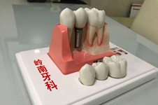 在南宁种植牙多少钱一颗 南宁这三家医院种植牙好且便宜！