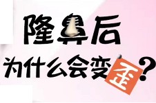 拆完鼻夹板后感觉鼻梁有点歪，大家说是不是医生的锅