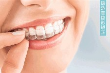 爱顿口腔揭秘：怎么选择一家可靠的牙齿矫正医院