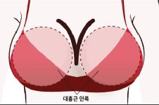 韩国隆胸价格一览表,含网评韩国隆胸较好的5家医院隆胸费用