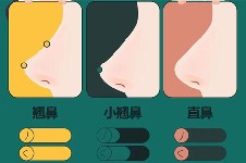 韩国id整形医院做鼻子怎么样?尤为重视整体协调感均衡感