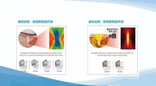 成都西部中西医结合医院主推7D聚拉提和热玛吉哪个效果好?