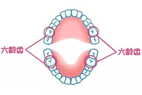 六龄齿坏了就剩根了怎么办？父母必须掌握的儿童蛀牙知识