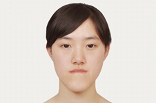 有没有能把长脸变短的手术？韩国改脸型口碑医院有哪些？
