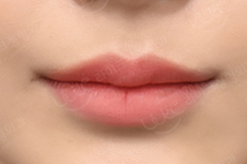 韩国来客整形外科优秀的唇整形院长叫什么名字？什么背景?