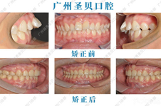 广州牙科医院前十排名公布,这十大私立口腔医院实力杠杠的!