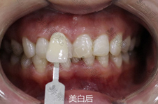 桂林有名气牙科诊所汇总,这些桂林靠谱口腔诊所你去过几家?