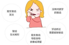 拔智齿收费价目表拔牙费用公布,医院拔智齿牙多少钱一颗？