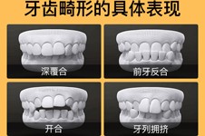 学生牙齿矫正多少钱？分享学生牙齿矫正价格表！