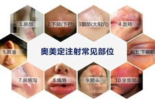 奥美定取出哪家医院技术好？这些取奥美定的医院值得面诊!