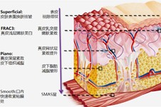 热玛吉五代和四代区别在哪,看热玛吉四代和五代哪个效果好!