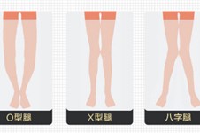 上海o型腿矫正的医院排名,揭秘上海矫正腿型哪家医院好强!