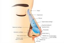 鼻综合都包括哪几项呢？鼻综合五项7项,大小鼻综合区别分析