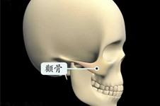 崔荣达做颧骨怎么样,做下颌角好吗?手术风格案例看技术怎样