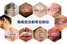 上海奧美定取出要多少錢？附異物取出好的醫(yī)生介紹！