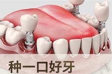 日本为什么停止使用种植牙?日本为什么不做种植牙真相揭秘!