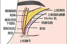 杜園園雙眼皮修復(fù)5萬貴嗎?有人感嘆上海杜園園修復(fù)好貴!