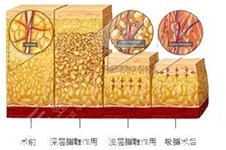 40多岁女人背越来越厚还能变薄!告诉你肩膀背部很厚怎么减!