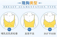 三门峡这三家医院假体丰胸超赞，连亲老公都发现不了