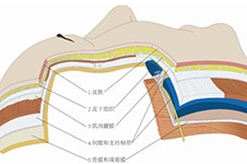 北京王馳拉皮手術(shù)技術(shù)怎么樣?技術(shù)和口碑都非常好！